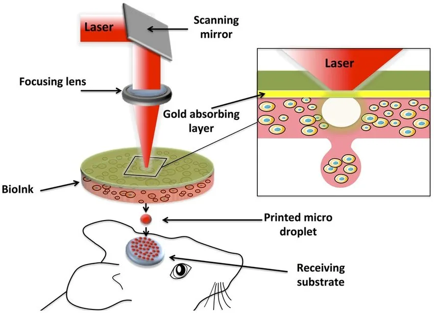 laser-assisted bioprinters